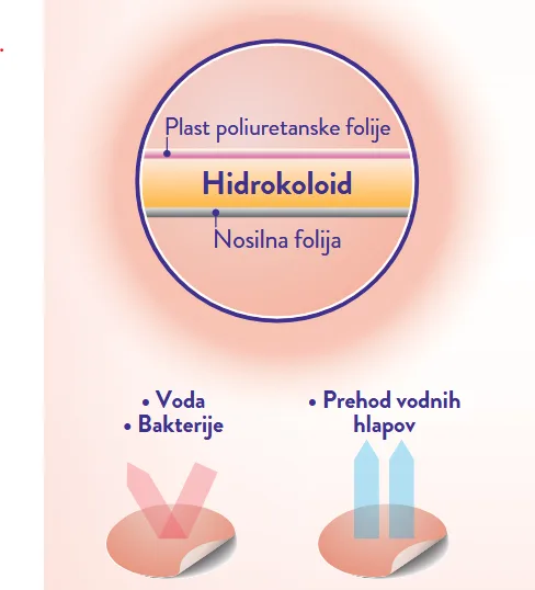 Obliži, ki lajšajo mozolje - slika 2