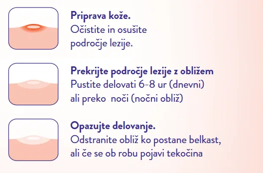 Obliži, ki lajšajo mozolje - slika 3