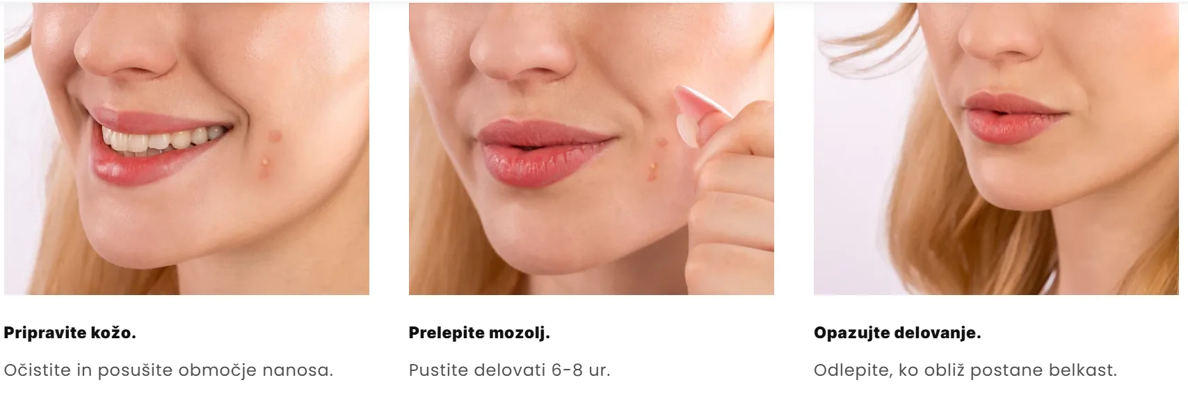 Nevidni obliži za mozolje